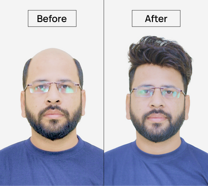 Mirage Hair System: A mirage of soft & shiny looking natural hair